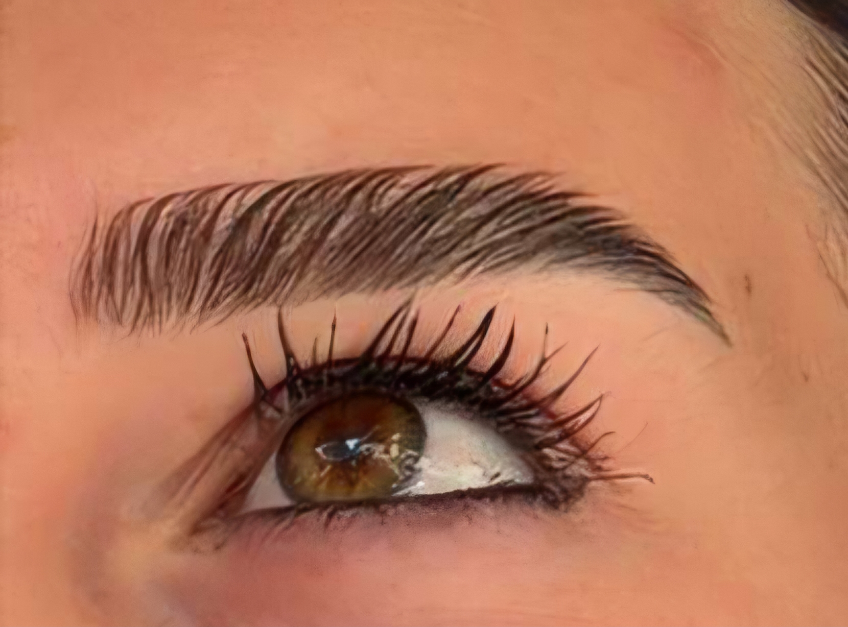 Browlift