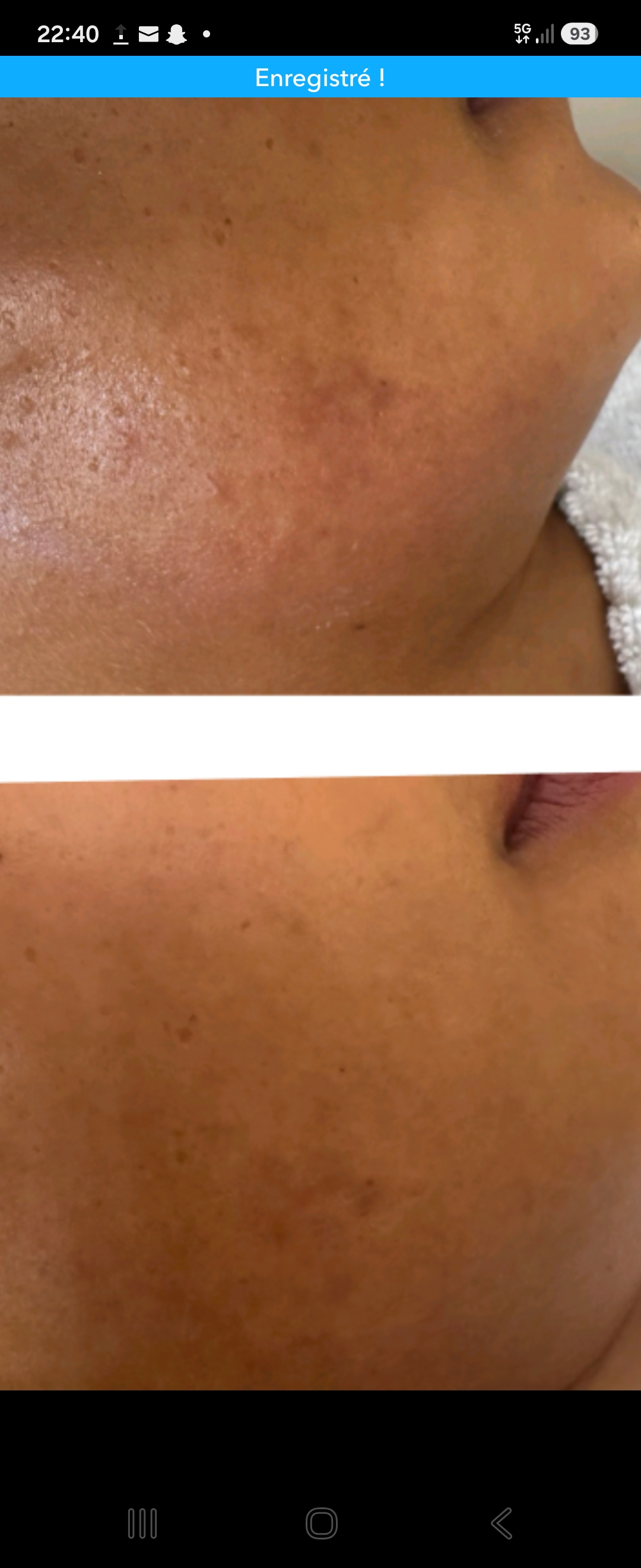 Soin peeling acides de fruits glycoliques 40%