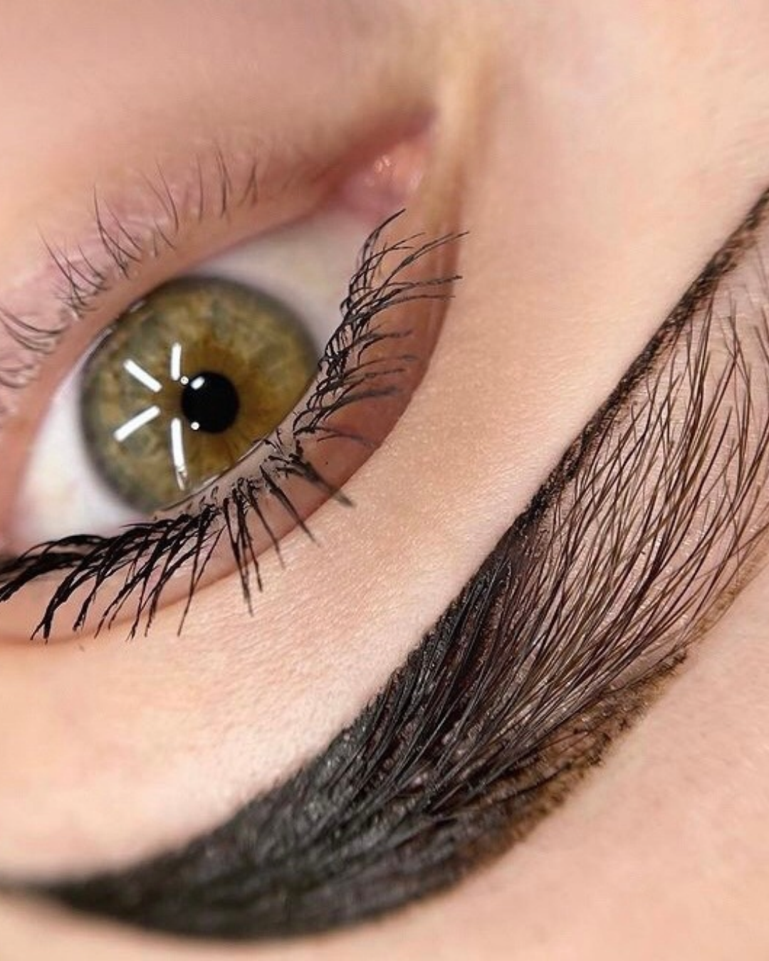Browlift rehaussement de sourcils
